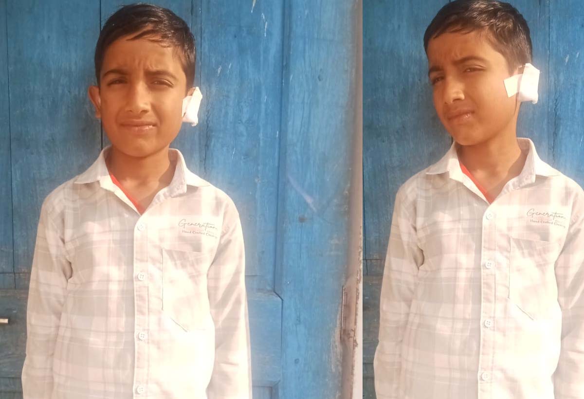 सीएम हेल्पलाइन बनी मज़ाक!  दर्द से तडफ़ रहा बच्चा, कोई सुनने वाला नहीं