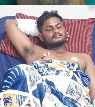 सिवनी जिले की उप तहसील उगली में हाई वोल्टेज करेंट से झुलसा आउटसोर्स विद्युत कर्मी"