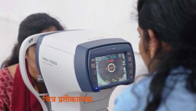 Doctors examining patients during free eye camp in Seoni