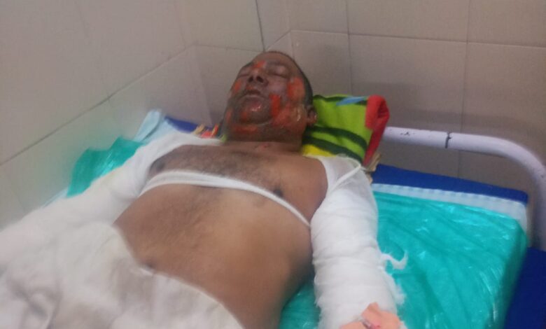 सिवनी में नरवाई की आग हादसे के बाद शिक्षक परिवार की स्थिति, घायल दंपति को अस्पताल ले जाते लोग